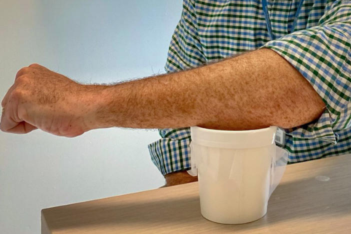 Sean Murphy, lead author of a new malaria vaccine study, demonstrates how participants got their dose: by placing an arm over a mesh-covered container filled with 200 mosquitoes whose bites delivered genetically modified malaria parasites.