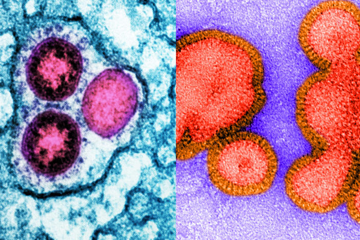 Health officials are predicting this winter could see an active flu season on top of potential COVID surges. In short, it's a good year to be a respiratory virus. Left: Image of SARS-CoV-2 omicron virus particles (pink) replicating within an infected cell (teal). Right: Image of an inactive H3N2 influenza virus.