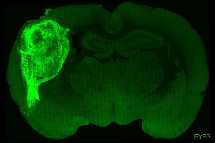 This cross-section of a rat brain shows tissue from a human brain organoid fluorescing in light green. Scientists say these implanted clusters of human neurons could aid the study of brain disorders.