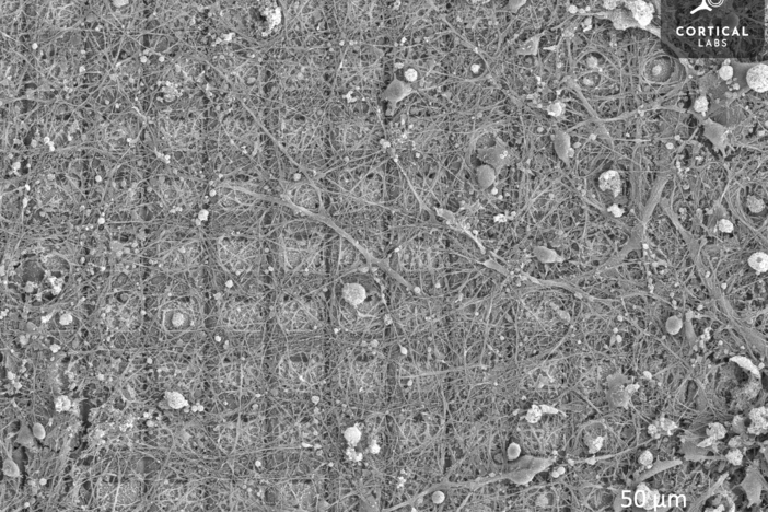 This scanning electron microscope image shows a neural culture growing on a high-density multi-electrode array. This system allowed researchers to train neurons to play the video game Pong.