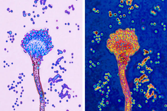 Aspergillus fumigatus can infect the lungs, causing pneumonia-like symptoms that can progress into more severe sickness.