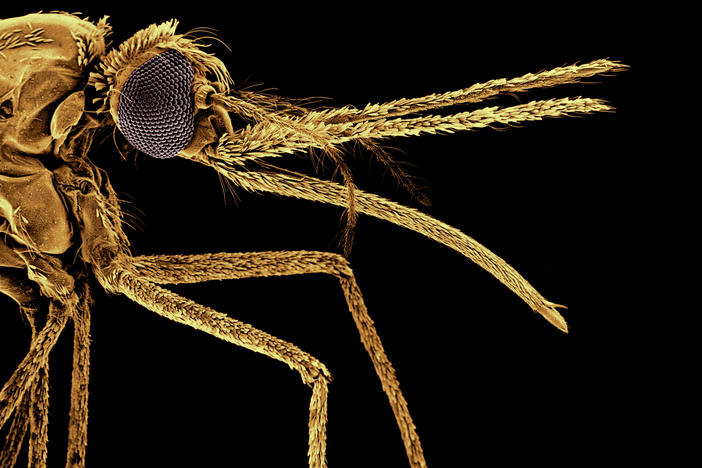 A color-enhanced micrograph of an a<em>nopheles stephens </em>mosquito, which has been behind dramatic malaria outbreaks in urban Ethiopia during the dry season, which is highly unusual.