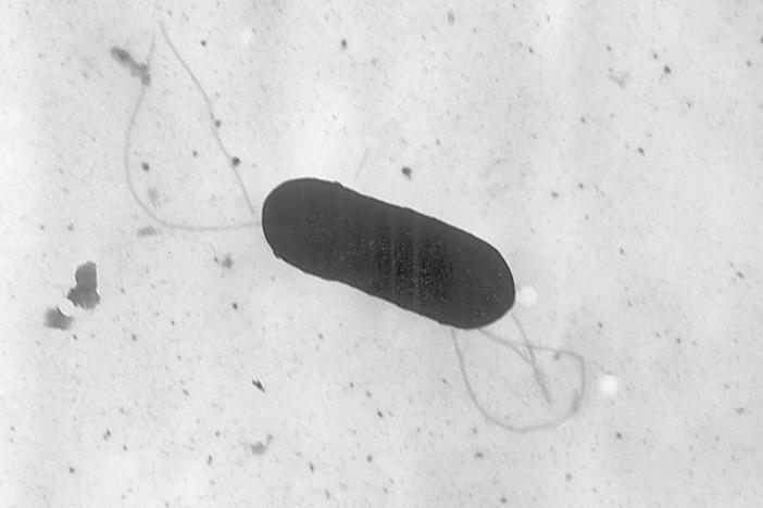This 2002 electron microscope image made available by the Centers for Disease Control and Prevention shows a Listeria monocytogenes bacterium, responsible for the food borne illness listeriosis. On Wednesday, Nov. 9, 2022, U.S. health officials said at least one death and a pregnancy loss are tied to an outbreak of listeria food poisoning associated with sliced deli meats and cheeses.