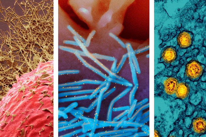 From left: 1) Colored scanning electron micrograph (SEM) of a human cell infected with H3N2 flu virus (gold filamentous particles). 2) Scanning electron micrograph of human respiratory syncytial virus (RSV) virions (colorized blue) that are shedding from the surface of human lung epithelial cells. 3) Transmission electron micrograph of SARS-CoV-2 Omicron virus particles (gold).