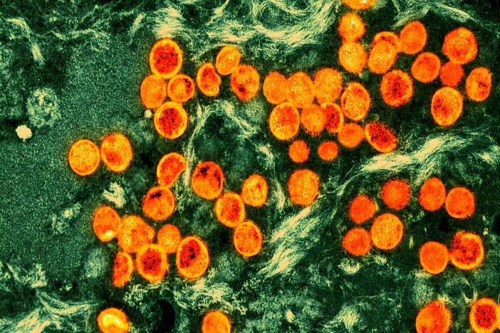 Monkeypox is getting a new name: mpox. Here, monkeypox virus particles (orange) are seen within an infected cell (green), after being cultured in a laboratory. The image was produced by a colorized transmission electron micrograph.