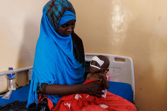 Fahir Mayow holds her nephew, eight-month-old Ahmed Noor, at Banadir Hospital in Mogadishu on Monday. Ahmed arrived at the hospital one week ago, weighing 3.5 kilograms, just under 8 pounds.