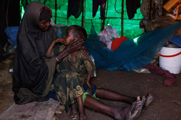 Mariam Kasim sits with her grandson, who she says is suffering from measles and malnutrition, at a camp on the outskirts of Baidoa, Somalia, on Tuesday.