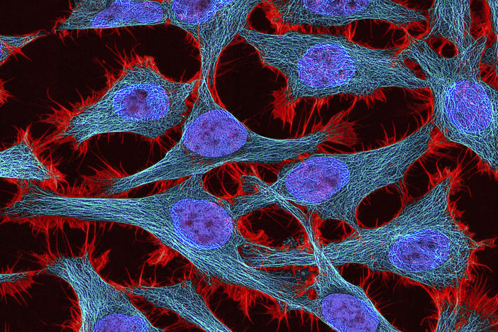 A microscopic image of HeLa cells, the "immortal cells" from Henrietta Lacks that grew indefinitely rather than reproducing just a few times.