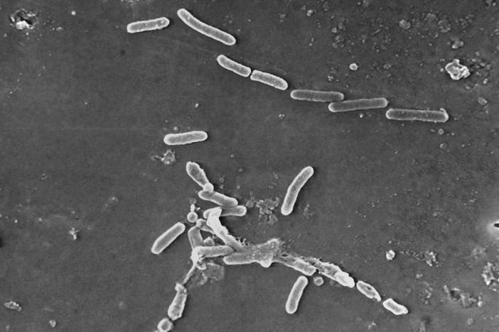 This scanning electron microscope image made available by the Centers for Disease Control and Prevention shows rod-shaped Pseudomonas aeruginosa bacteria. U.S. health officials are advising people to stop using the over-the-counter eye drops, EzriCare Artificial Tears, that have been linked to an outbreak of drug-resistant infections of Pseudomonas aeruginosa.