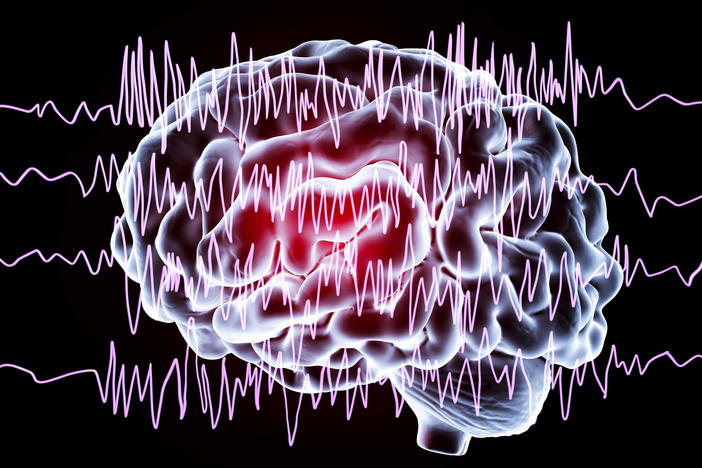 If the brain is a musical instrument, "the electrophysiology is the music," says <a href="https://profiles.ucsd.edu/alexander.khalessi">Dr. Alexander Khalessi</a>. New tools to treat epilepsy patients now let doctors "listen to the music a little bit better."