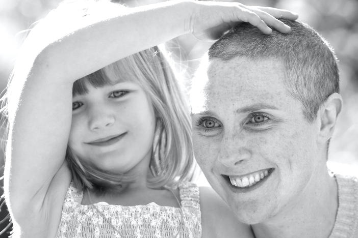 Laura Holmes Haddad lost her hair when she was undergoing chemo. She said she was self-conscious until an X-ray tech offered a new perspective on baldness.