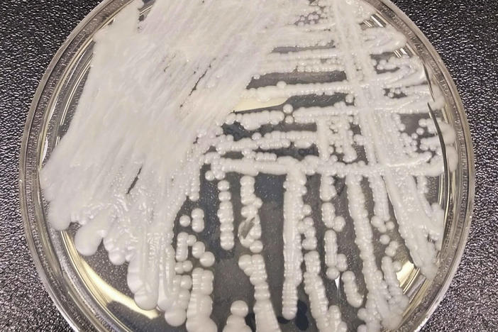 This undated photo made available by the Centers for Disease Control and Prevention shows a strain of Candida auris cultured in a petri dish.