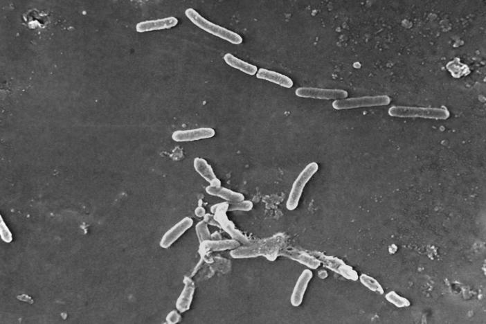 Pseudomonas aeruginosa bacteria as seen under a microscope. The Centers for Disease Control and Prevention says 68 people have become infected with a drug-resistant strain of the bacteria, with many infections linked to the use of contaminated eye drops.