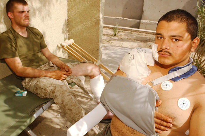 U.S. Marine Corps Lance Cpls. Chris Covington (left) and Carlos Gomez Perez recover from shrapnel and bullet wounds on April 27, 2004, after Iraqi insurgents attacked near Fallujah, Iraq. Just two weeks earlier, Covington and Gomez Perez helped evacuate wounded Marines and soldiers after a deadly explosion rocked a schoolhouse in Fallujah.