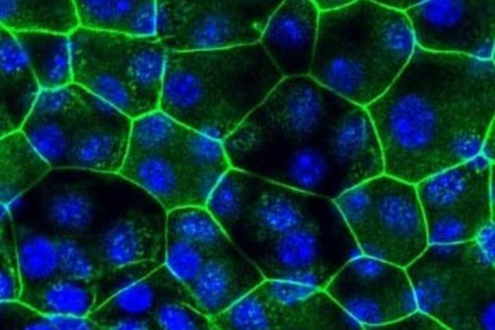 Microscope images of urinary tract cells from mice that were not given a UTI (naive) and those that were susceptible to recurrent UTIs (sensitized). Cells are outlined in green and the DNA in each cell glows blue. The cells susceptible to recurrent UTIs are smaller.