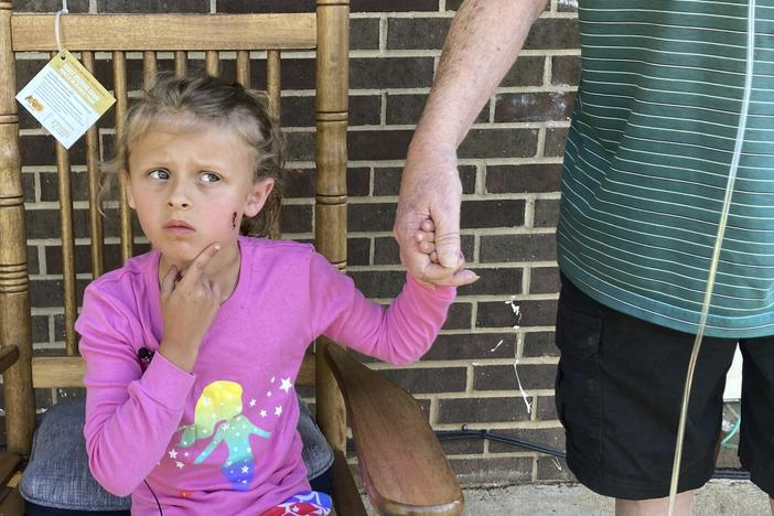 Kinsley White, 6, shows reporters her wound on Thursday in Gastonia, N.C.