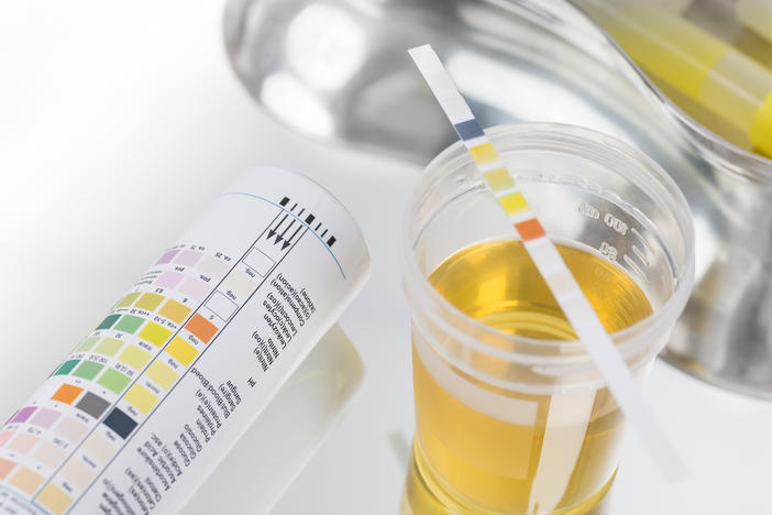 Some urinary tract infections may be caused by food-borne <em>E. coli</em> bacteria, research finds.