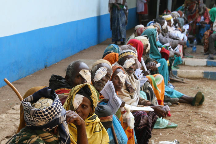 Even a straightforward cataract surgery may be impossible in many places. These patients underwent surgery as part of a campaign run by Himalayan Cataract Project at the Bisidimo Hospital in Ethiopia. Surgeons performed more than 1,600 cataract surgeries during a six-day event.
