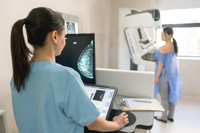 New recommendations from the USPSTF advise that women get biannual mammograms starting at age 40 to detect breast cancers.