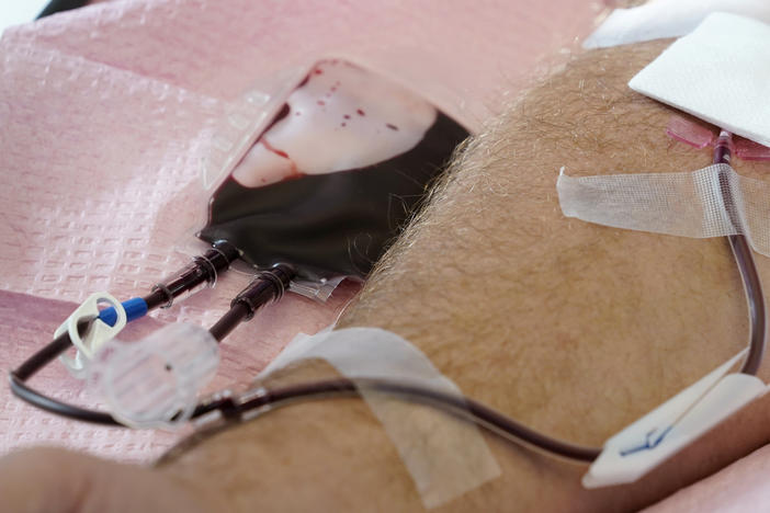 The U.S. is moving to ease restrictions on blood donations from gay and bisexual men and other groups that traditionally face higher risks of HIV. Here, tubes direct blood from a donor into a bag in Davenport, Iowa, on Friday, Nov. 11, 2022.