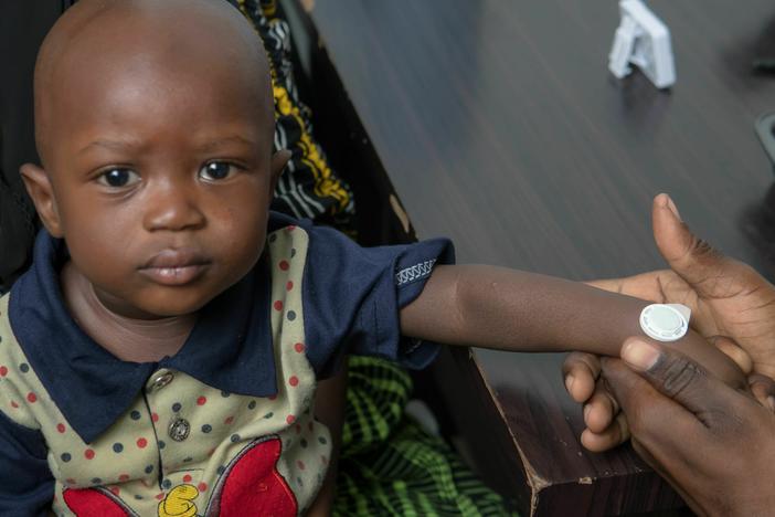 Study participants in The Gambia received a measles vaccine through a virtually pain-free sticker. Early data on adults and children as young as nine months suggest the syringe-free skin patch is safe and effective.