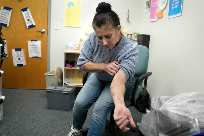 Amy Treglia shows scarring on her arms caused by xylazine, a veterinary tranquilizer that is being used as a cutting agent for heroin and fentanyl.