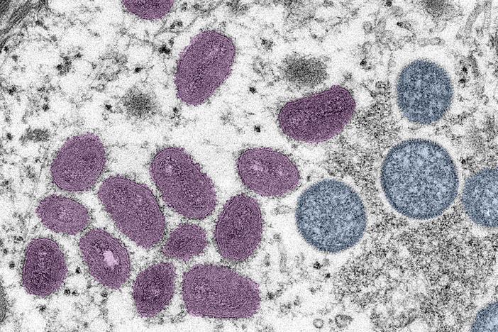 An electron microscopic image of mpox virus particles. The mpox emergency of last summer is over. Was it a passing threat? Or is there reason to believe another global outbreak could happen.