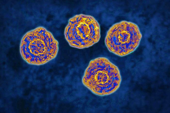 Hepatitis C can cause severe liver damage and leads to about 15,000 deaths in the U.S. each year.