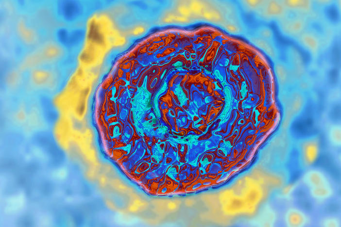 An image of the hepatitis C virus  Image made from a transmission electron microscopy. The virus is adept at evading the immune system.