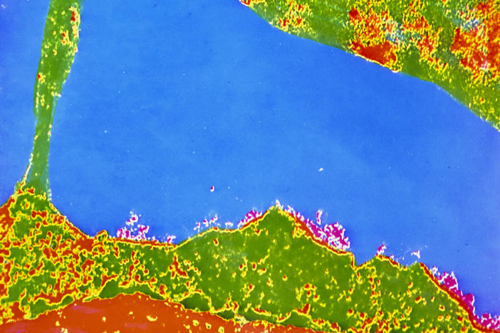 This colorized transmission electron micrograph of a human white blood cell (bottom) shows the HLA antigen — the uneven red areas on the cell's exterior surface. A variant of the HLA gene could play a role in warding off COVID symptoms.