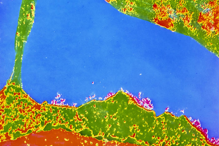 This colorized transmission electron micrograph of a human white blood cell (bottom) shows the HLA antigen — the uneven red areas on the cell's exterior surface. A variant of the HLA gene could play a role in warding off COVID symptoms.