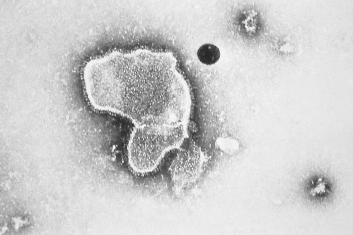 An electron micrograph of Respiratory Syncytial Virus, also known as RSV, which is the leading cause of hospitalizations among infants in the U.S.