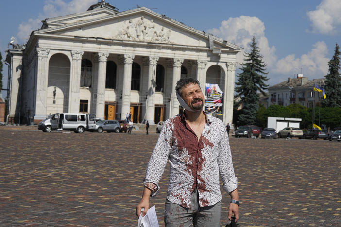 An injured man walks in Krasna Square in front of the Taras Shevchenko Chernihiv Regional Academic Music and Drama Theatre, after a Russian attack on Chernihiv, Ukraine, on Saturday.