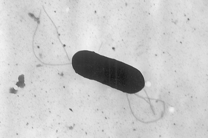 A listeria bacterium seen under an electron microscope. Listeria is not typically life-threatening, but those over 65, pregnant or with compromised immune systems are deemed high-risk when exposed to the bacteria.