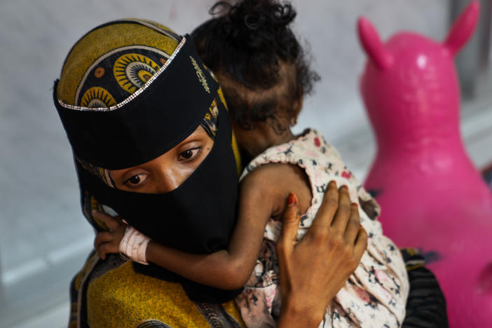 Laila Aseel, 24, holds her 1-year-old daughter, Aram. Aseel came to the hospital from an internally displaced persons camp, where she was living with her husband and four children after fleeing fighting in the north. She says she is unable to feed her kids more than one meal a day; when she arrived at the hospital, her daughter was near death from malnutrition.