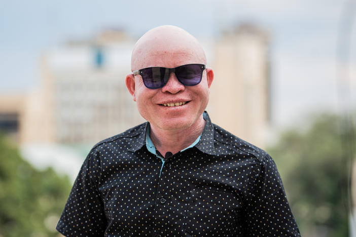 John Chiti is a Zambian musician and police commissioner. He also has albinism, a pigmentation condition that has shaped his life. His story inspired the film "Can You See Us?" — now streaming on Netflix.