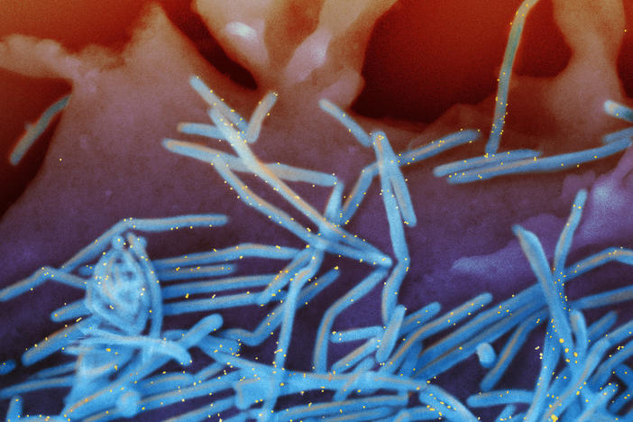 Advisors to the Centers for Disease Control and Prevention have recommended a new RSV vaccine to protect newborns by immunizing their moms late in pregnancy.