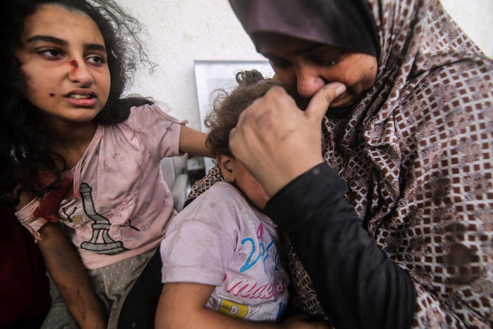 People injured from Israeli air strikes on Oct. 12 wait outside a hospital to be treated. The sheer volume of medical need is overwhelming the small and exhausted number of staff at Gaza's medical facilities, says Dr. Mohammad Mattar, head of the radiology department at Al Shifa Hospital, the Gaza Strip's largest medical complex.