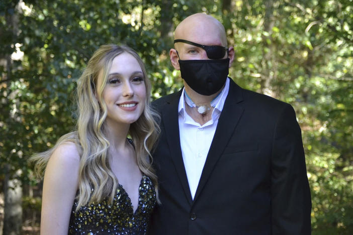 This family photo shows Aaron James and his daughter, Allie in September 2022. Aaron was working for a power line company in June 2021 when he was shocked by a live wire. He nearly died. Ultimately he lost his left arm, requiring a prosthetic. His damaged left eye was so painful it had to be removed.
