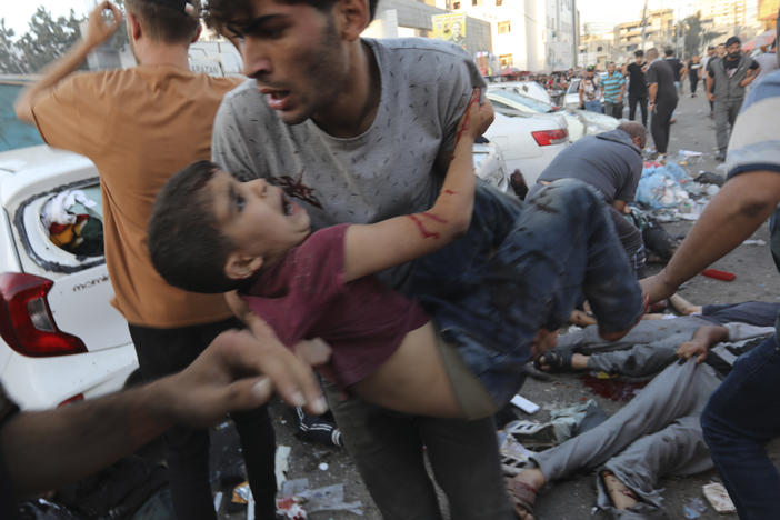 An injured Palestinian boy is carried away in the aftermath of an Israeli airstrike outside the entrance of the al-Shifa hospital in Gaza City on Nov. 3. Israel said it targeted Hamas members using an ambulance to leave the hospital. Hamas denied this. Hospital officials said 13 people were killed and dozens injured.