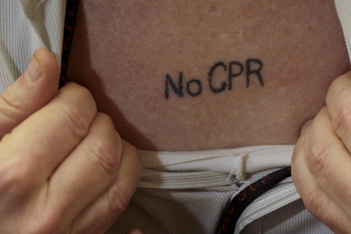 Some people have their medical wished tattooed on their bodies. CPR can save lives, especially for the young and healthy, but can add pain and chaos to a frail, sick patient's last moments.