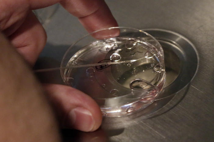 An Alabama Supreme Court Ruling that classifies frozen embryos as "extrauterine children" has led to uncertainty for IVF patients and clinics in the state.