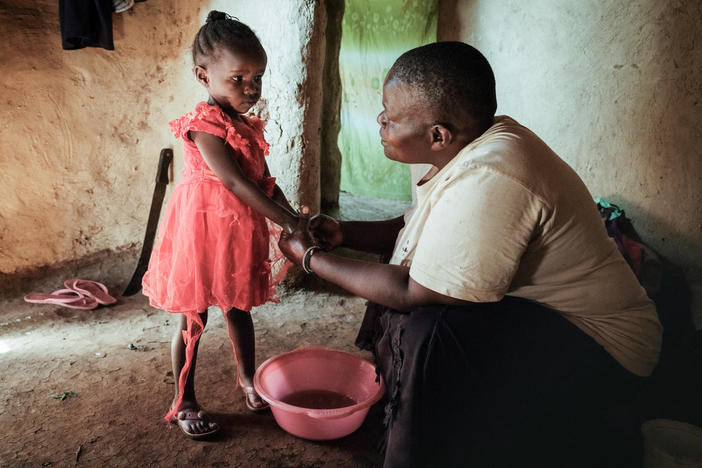 Isabela Oside, 45, washes hands of her daughter Faith, 3, who completed doses through the worlds first malaria vaccine. Malaria is one of the preventable diseases that contributes to worldwide child mortality.