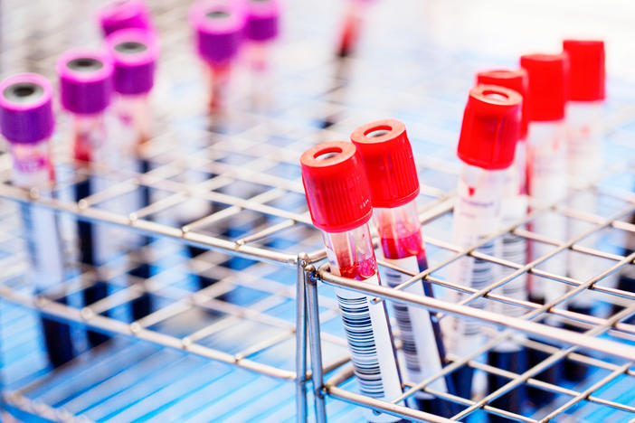 If the FDA approves it, a new blood test could become another screening option for colorectal cancer.