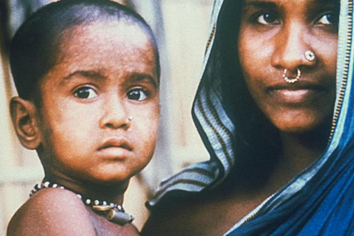 Rahima Banu had the last recorded case of naturally occurring variola major smallpox, a deadly strain of the virus, in 1975. At left: Banu in her mother's arms as a small child. At right: Banu today, close to 50 years old, lives in a small village in Bangladesh with her husband, Rafiqul Islam, and their children.