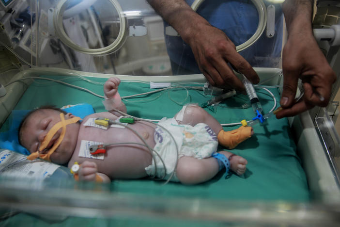 A baby is looked after at the neonatal unit at Kamal Adhwan hospital in Beit Lahia in the Gaza Strip, where children are born with complications due to malnourished mothers.
