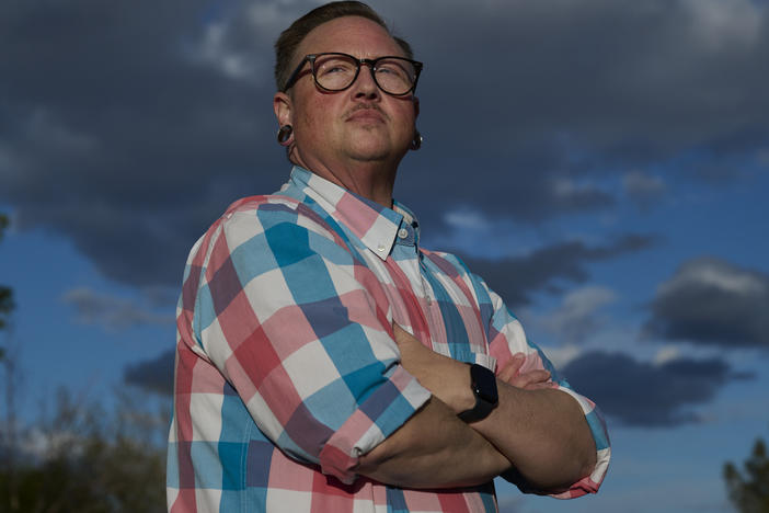 When he arranged to undergo top surgery, Cass Smith-Collins of Las Vegas selected a surgeon touted as an early developer of the procedure who does not contract with insurance. "I had one shot to get the chest that I should have been born with, and I wasn't going to chance it to someone who was not an expert at his craft," he says.