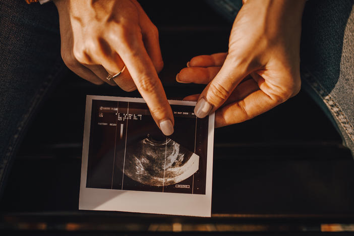 The medical community dates pregnancy to the first day of a woman's last period, even though fertilization generally happens two weeks after that. It's a long-standing practice but a confusing one.
