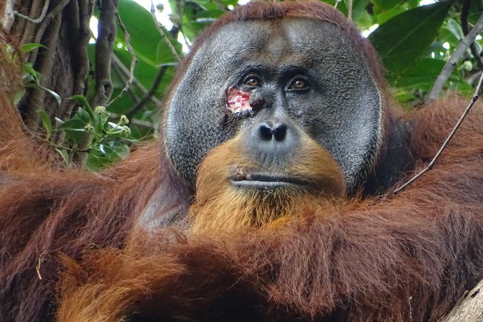 Researchers in a rainforest in Indonesia spotted an injury on the face of a male orangutan they named Rakus. They were stunned to watch him treat his wound with a medicinal plant.
