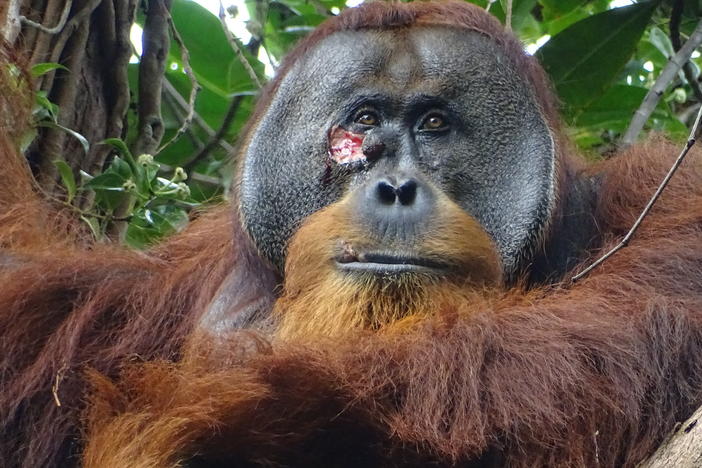 Researchers in a rainforest in Indonesia spotted an injury on the face of a male orangutan they named Rakus. They were stunned to watch him treat his wound with a medicinal plant.